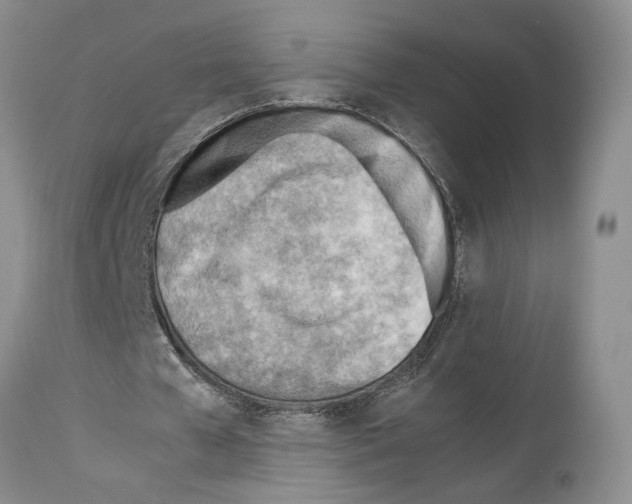 X0000114060577200911161131