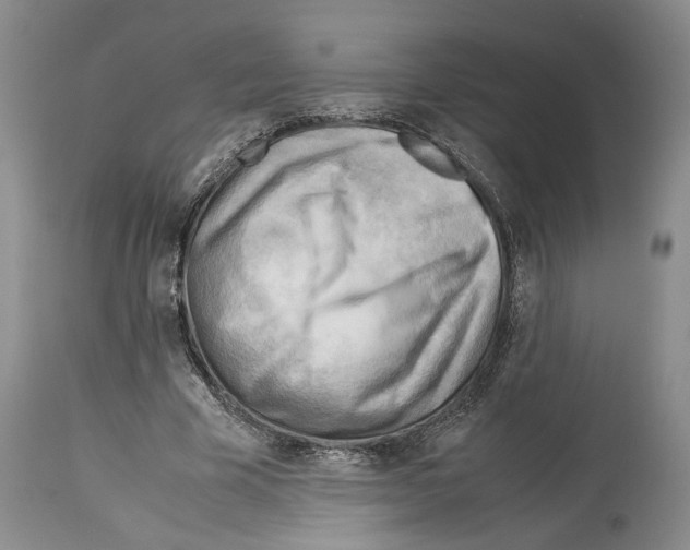 X0000114060585200911161131