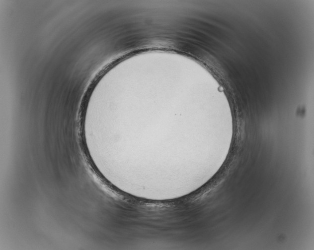 X0000114061037200911161124