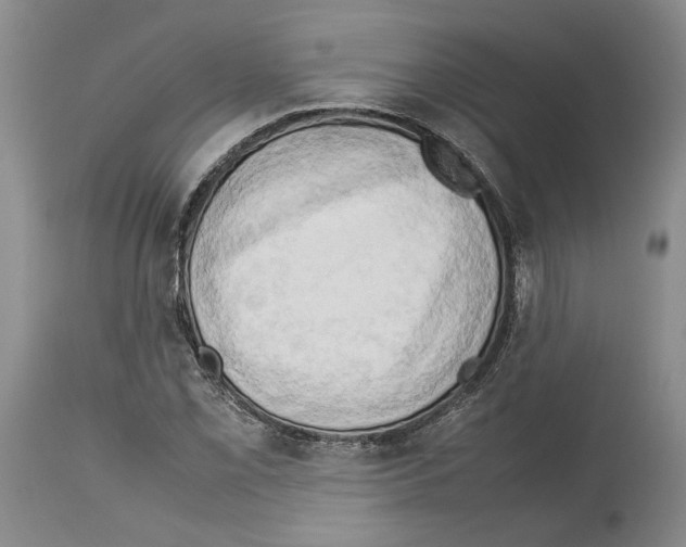 X0000114061069200911161123