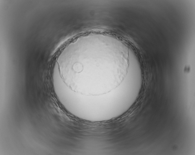 X0000114061256200911161120