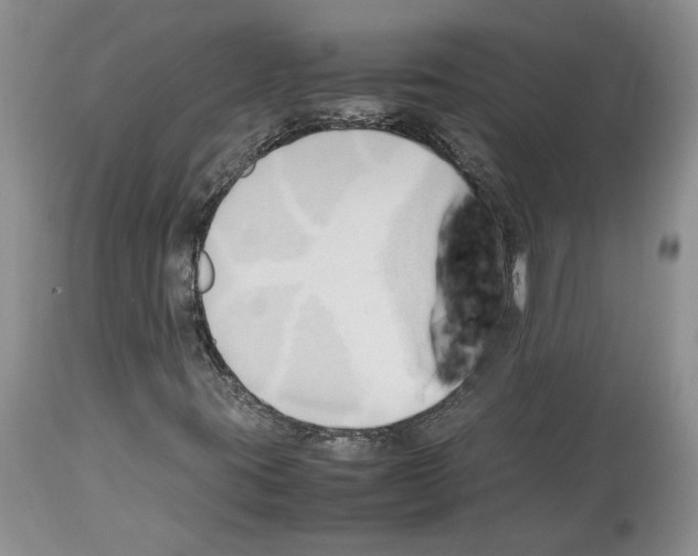 X0000114061395200911161118