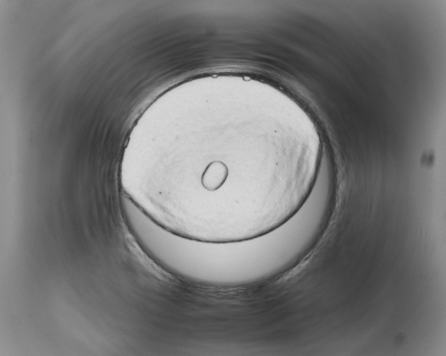 X0000114061417200911161118