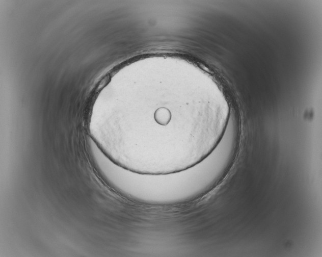 X0000114061449200911161118