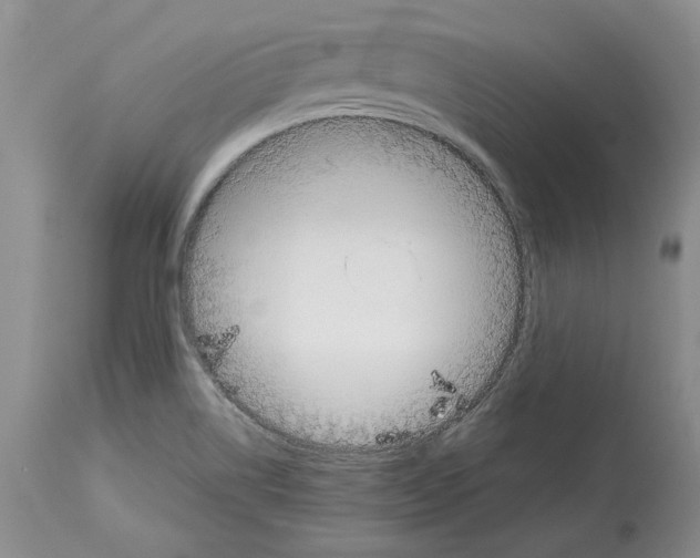 X0000114061514200911161117