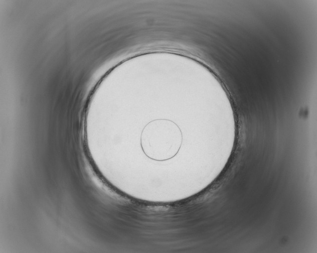 X0000114061515200911161117