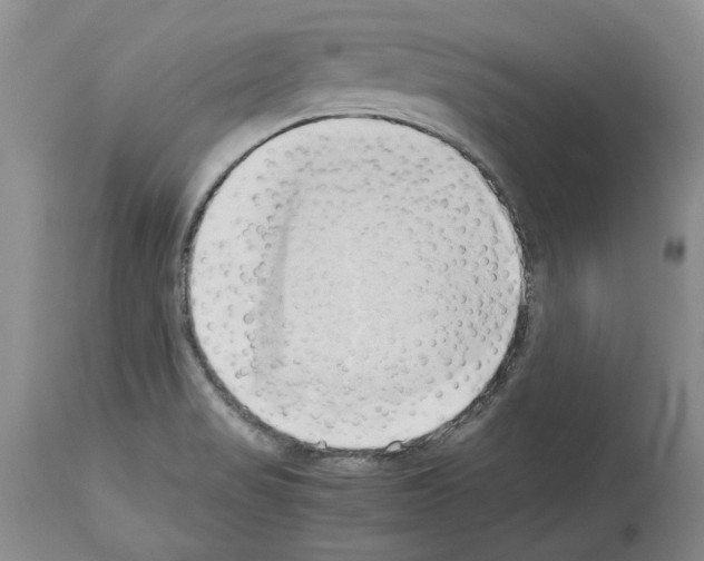 X0000114061517200911161117