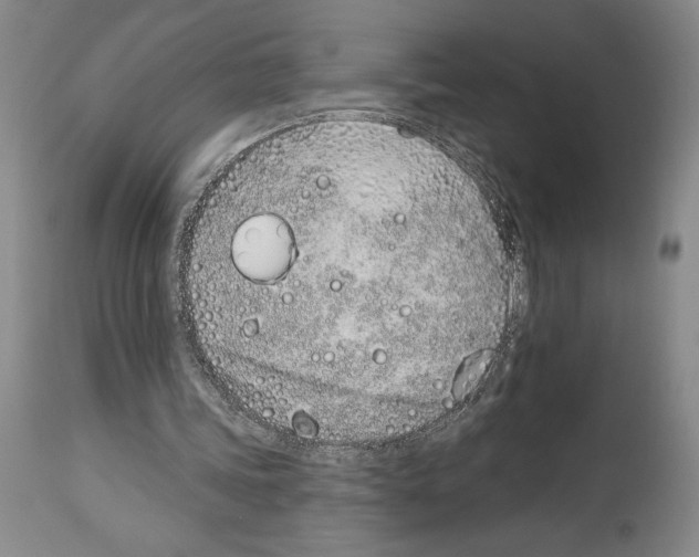 X0000114070339200911161157