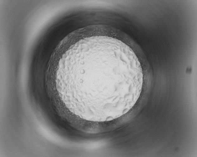 X0000114070765200911161152