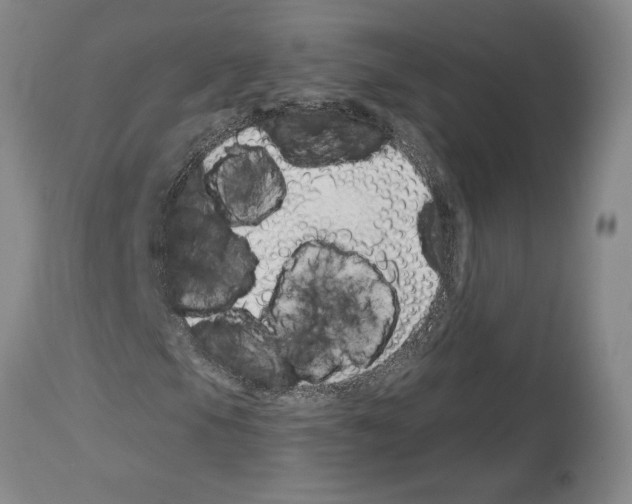 X0000114071105200911161145