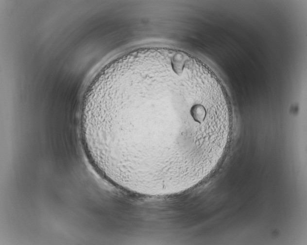 X0000114071245200911161145