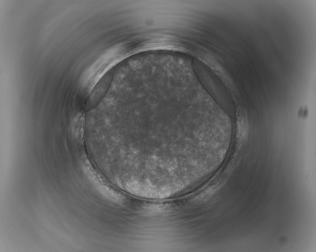 X0000114071369200911161142