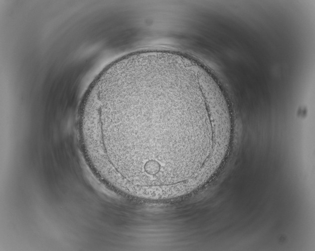 X0000114071470200911161140