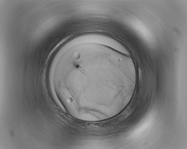 X0000114080387200911161020