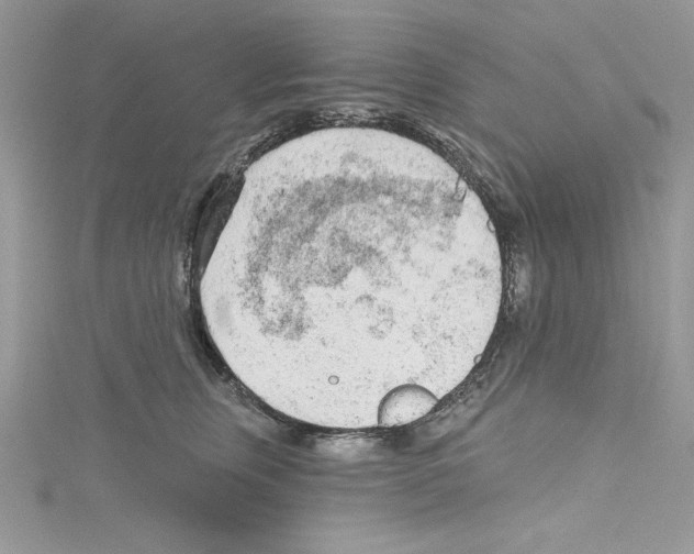 X0000114080759200911161015