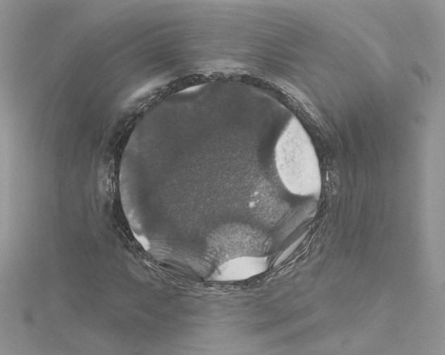 X0000114081063200911161011