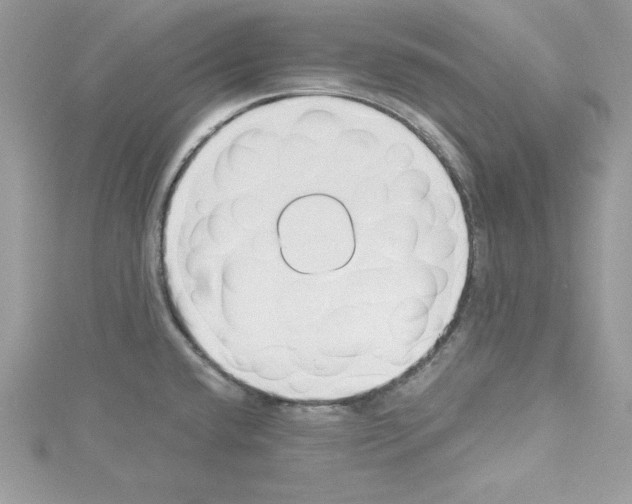 X0000114081432200911161006