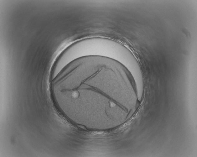 X0000114090152200911161044
