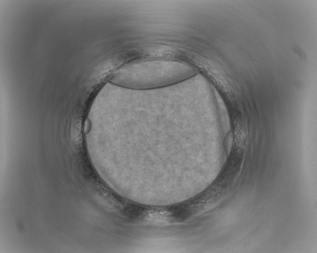 X0000114090403200911161041