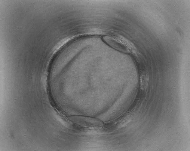 X0000114090436200911161040