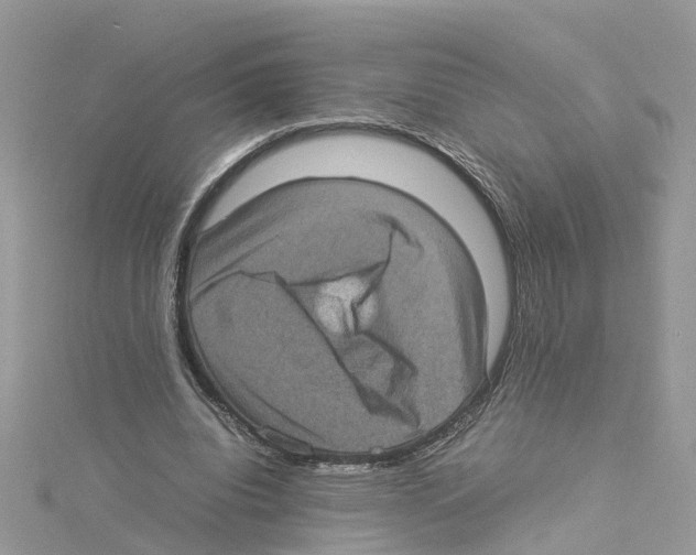 X0000114090440200911161040