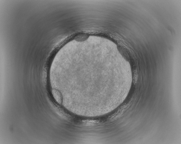 X0000114090448200911161040