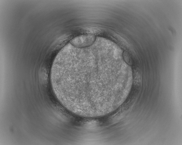 X0000114090456200911161040