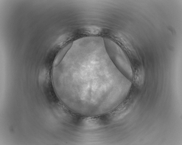 X0000114090568200911161039