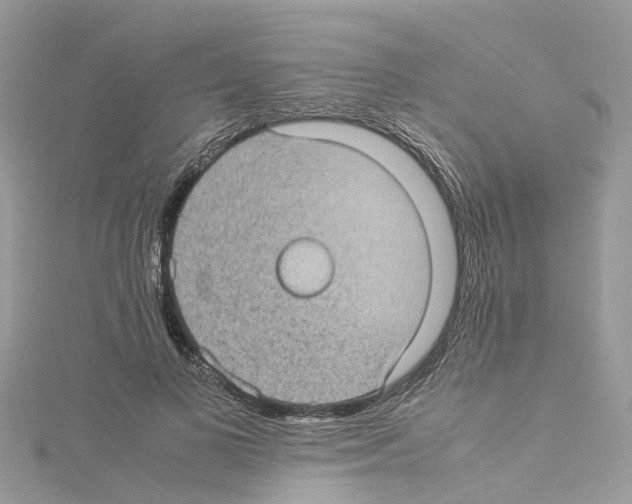 X0000114090693200911161037