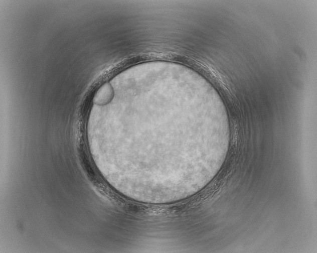 X0000114090736200911161037