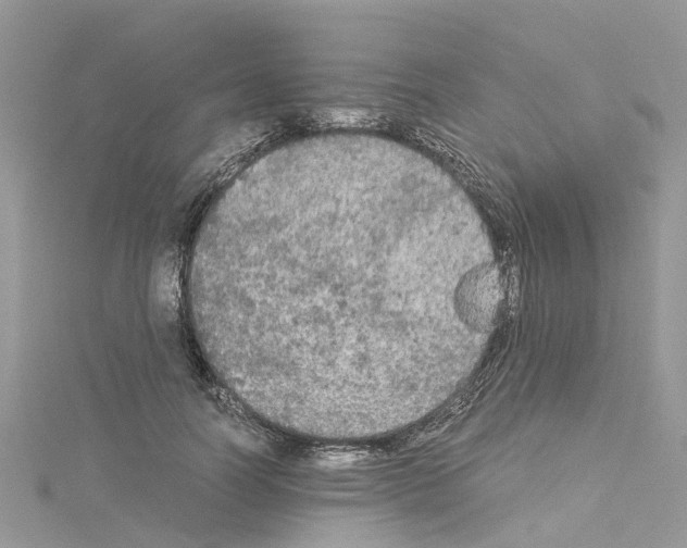 X0000114090746200911161037