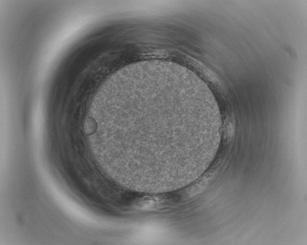 X0000114090764200911161037