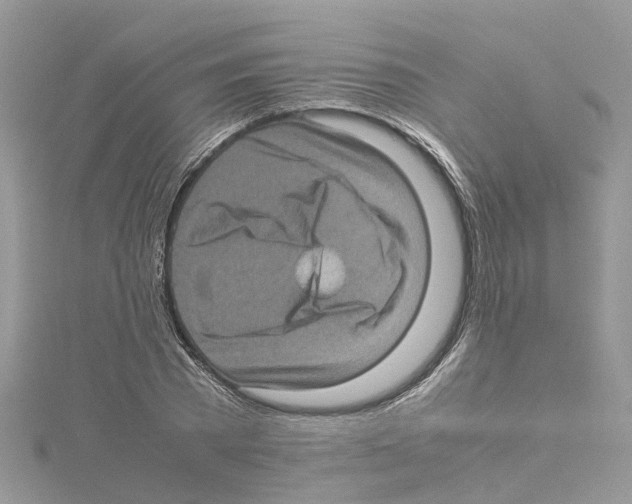 X0000114090785200911161036