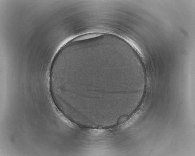 X0000114090854200911161036