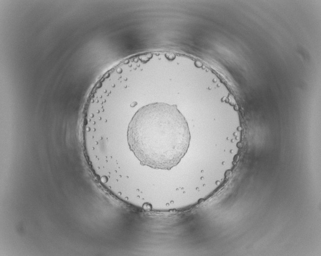 X0000114090856200911161036