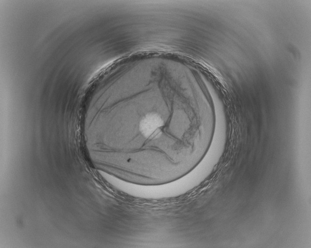 X0000114090872200911161035