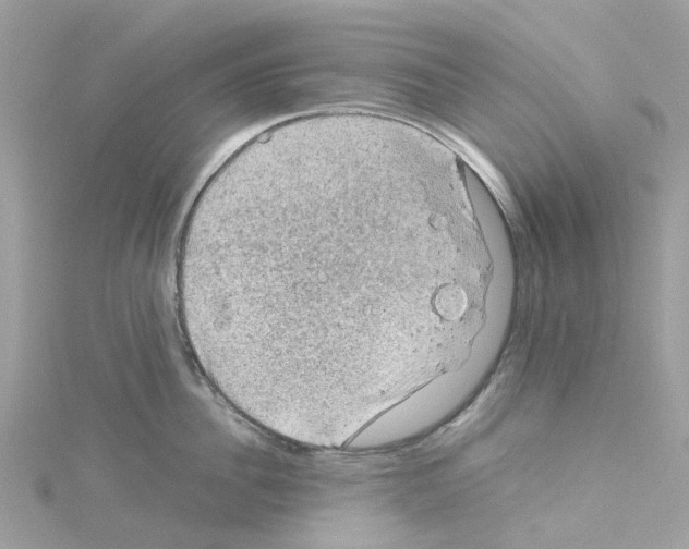 X0000114090956200911161034