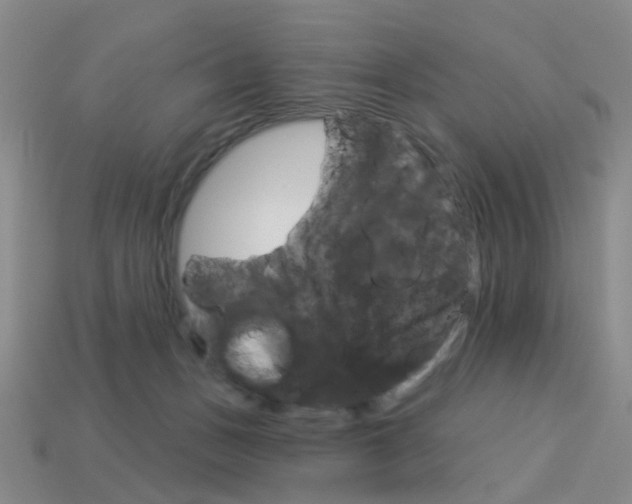 X0000114100175200910051238