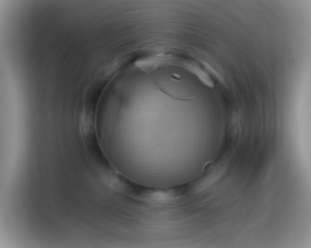 X0000114100236200910051451