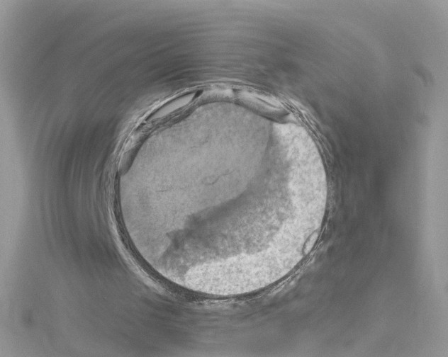 X0000114100049200911161107