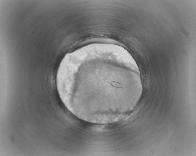 X0000114100086200911161107