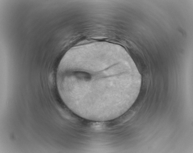 X0000114100088200911161107