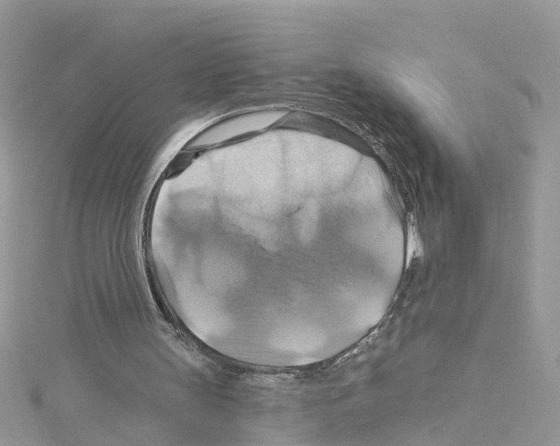 X0000114100147200911161105