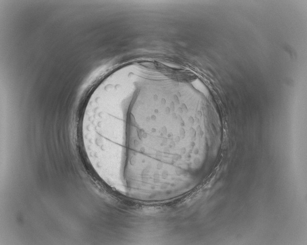 X0000114100149200911161105