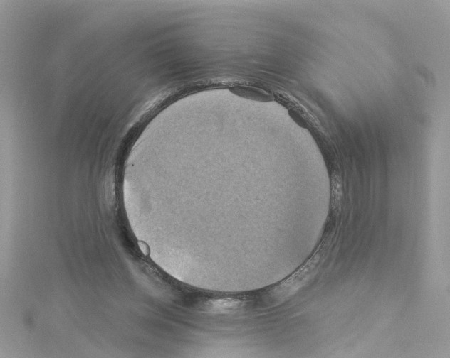 X0000114100158200911161105