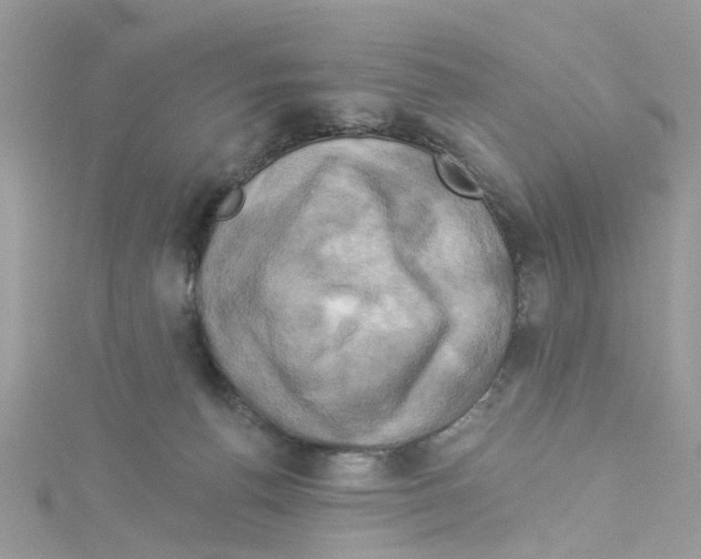 X0000114100176200911161106