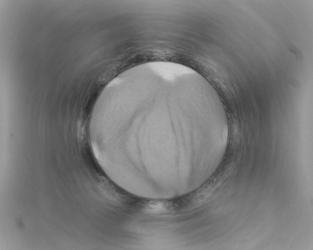 X0000114100177200911161106