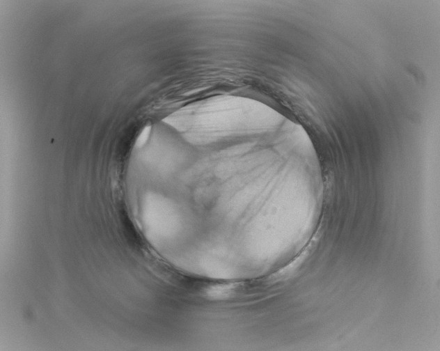 X0000114100178200911161106