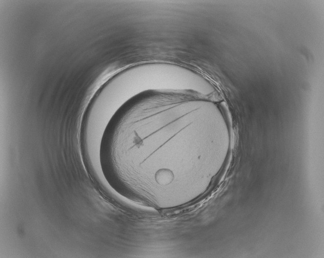 X0000114100195200911161105