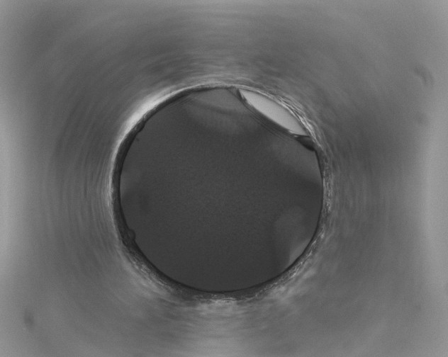 X0000114100196200911161105